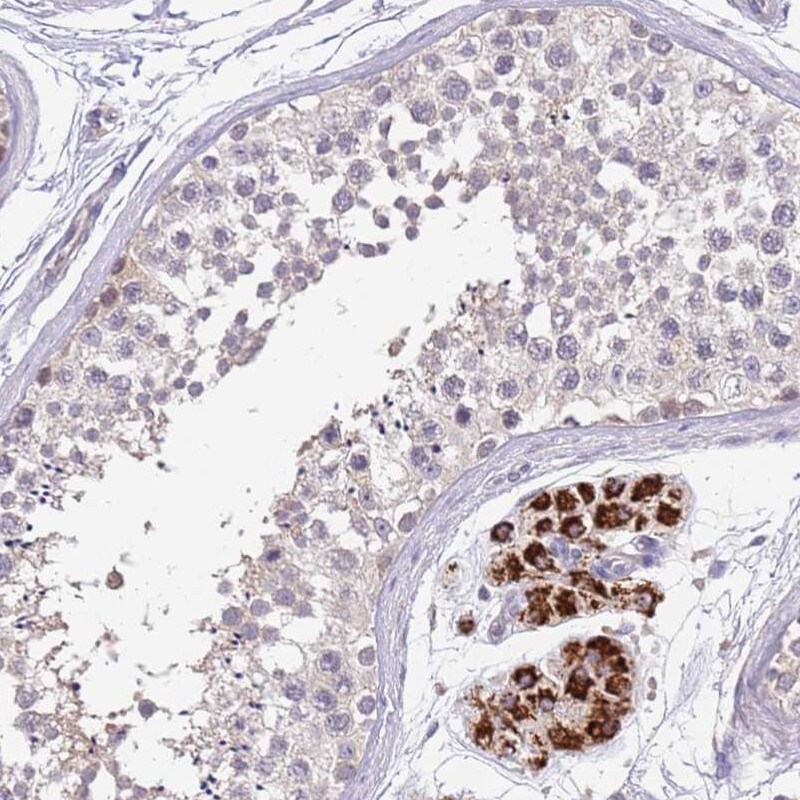 ZNF746 Antibody - BSA Free Immunohistochemistry: ZNF746 Antibody - BSA Free [NBP2-13594]