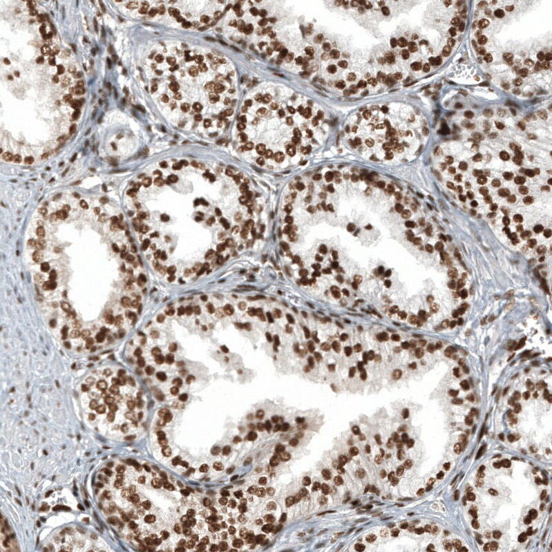 ZNF827 Antibody - BSA Free Immunohistochemistry: ZNF827 Antibody - BSA Free [NBP2-13599]