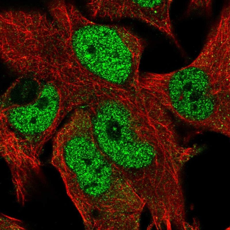 ZNF827 Antibody - BSA Free Immunocytochemistry/ Immunofluorescence: ZNF827 Antibody - BSA Free [NBP2-13599]