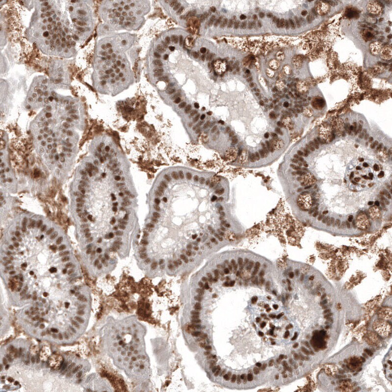 ZNF827 Antibody - BSA Free Immunohistochemistry: ZNF827 Antibody - BSA Free [NBP2-13599]