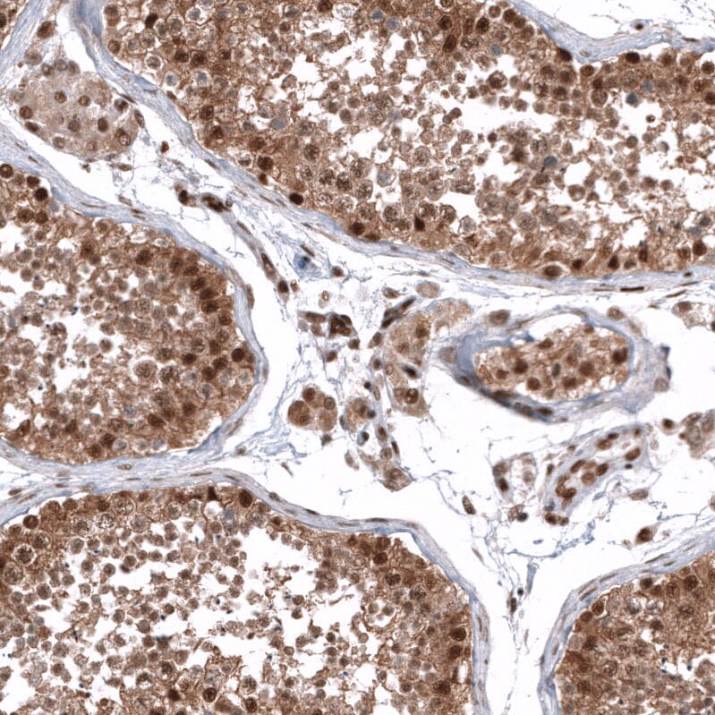 ZNF827 Antibody - BSA Free Immunohistochemistry: ZNF827 Antibody - BSA Free [NBP2-13599]