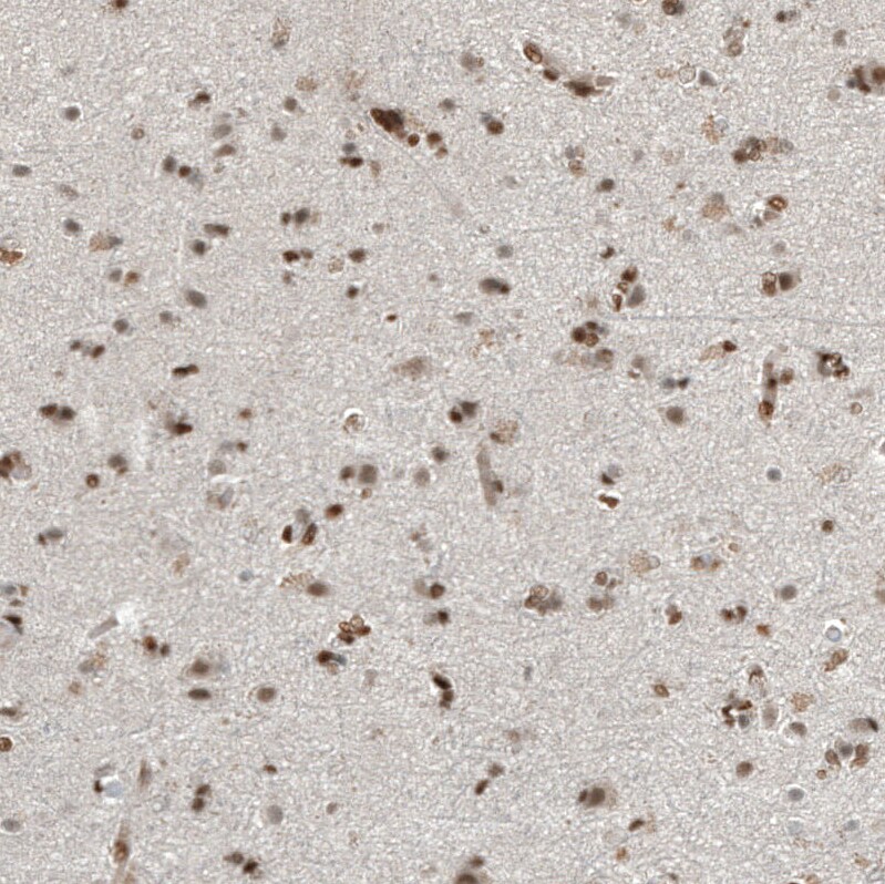 ZNF827 Antibody - BSA Free Immunohistochemistry: ZNF827 Antibody - BSA Free [NBP2-13599]