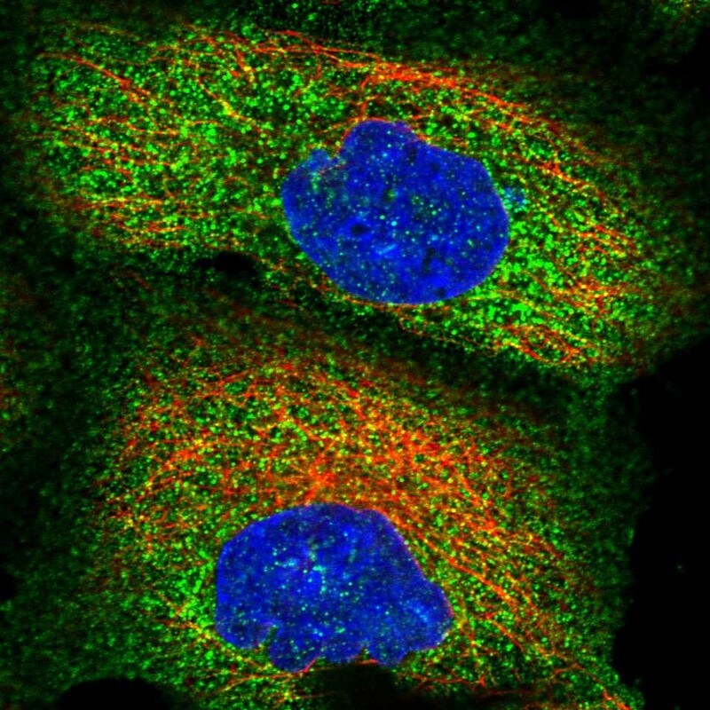 ZSWIM1 Antibody - BSA Free Immunocytochemistry/ Immunofluorescence: ZSWIM1 Antibody [NBP2-13606]