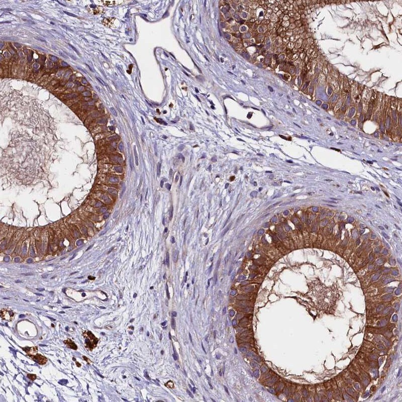 ZSWIM1 Antibody - BSA Free Immunohistochemistry-Paraffin: ZSWIM1 Antibody [NBP2-13606]