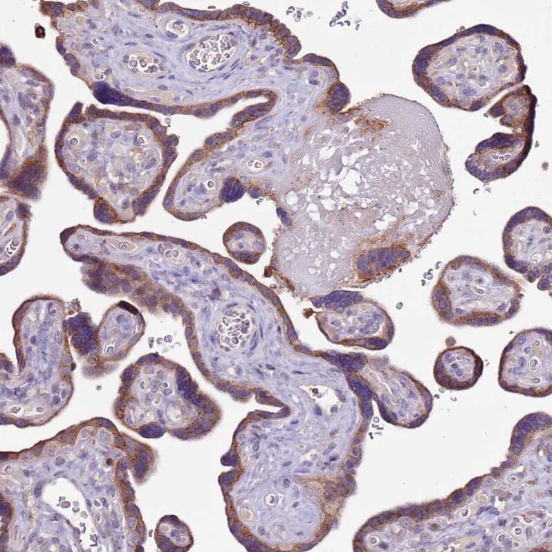 ZSWIM1 Antibody - BSA Free Immunohistochemistry: ZSWIM1 Antibody - BSA Free [NBP2-13607]