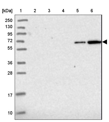 ZSWIM1 Antibody - BSA Free Western Blot: ZSWIM1 Antibody - BSA Free [NBP2-13607]
