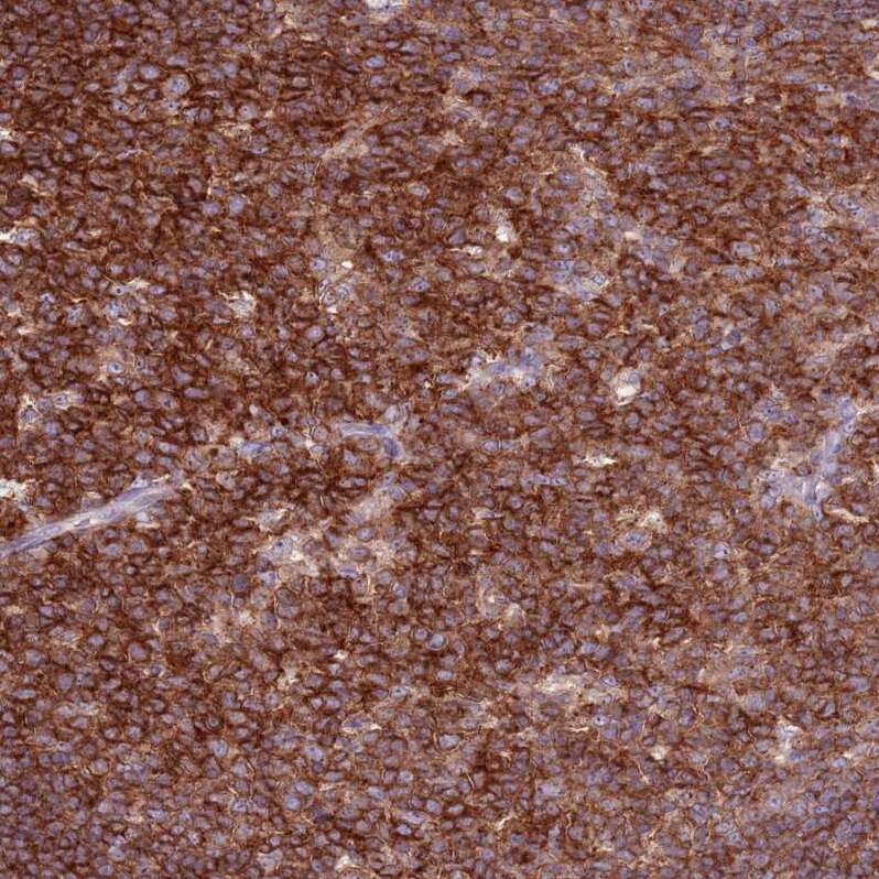 ZSWIM1 Antibody - BSA Free Immunohistochemistry: ZSWIM1 Antibody - BSA Free [NBP2-13607]