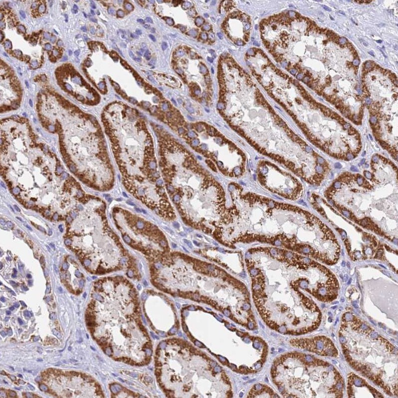 MRPS12 Antibody - BSA Free Immunohistochemistry: MRPS12 Antibody - BSA Free [NBP2-13620]