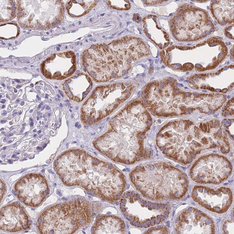 MRPS14 Antibody - BSA Free Immunohistochemistry: MRPS14 Antibody - BSA Free [NBP2-13622]