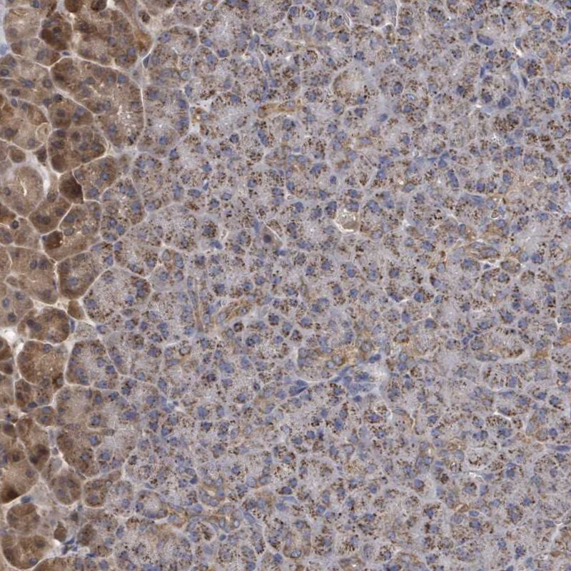 MTMR12 Antibody - BSA Free Immunohistochemistry: MTMR12 Antibody - BSA Free [NBP2-13625]