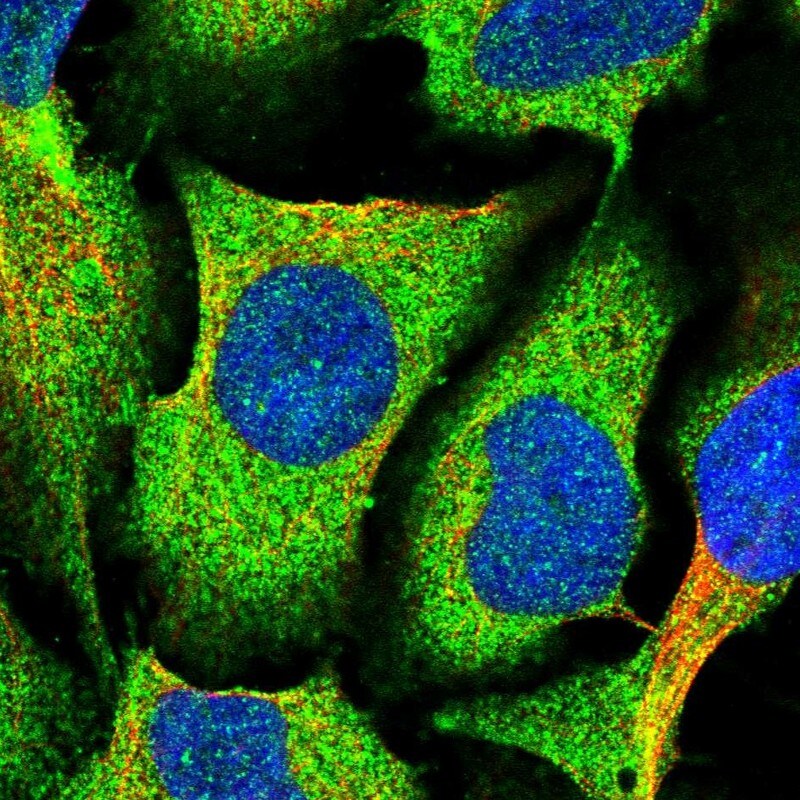 MVD Antibody - BSA Free Immunocytochemistry/ Immunofluorescence: MVD Antibody [NBP2-13628]