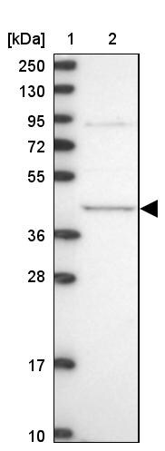 MVD Antibody - BSA Free Western Blot: MVD Antibody - BSA Free [NBP2-13628]