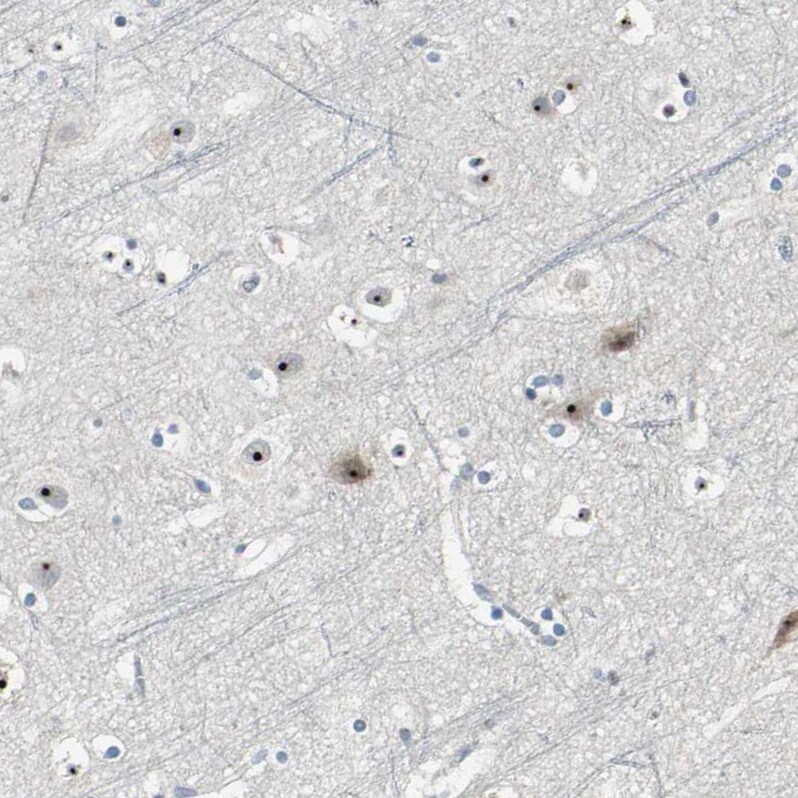 MYBBP1A Antibody - BSA Free Immunohistochemistry: MYBBP1A Antibody - BSA Free [NBP2-13630]