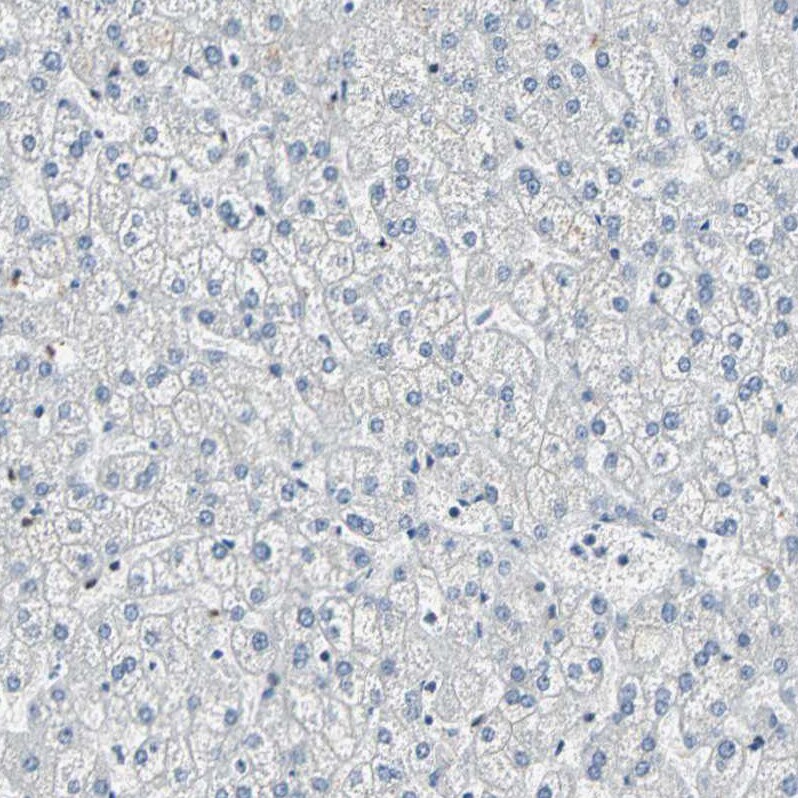 MYBBP1A Antibody - BSA Free Immunohistochemistry: MYBBP1A Antibody - BSA Free [NBP2-13630]