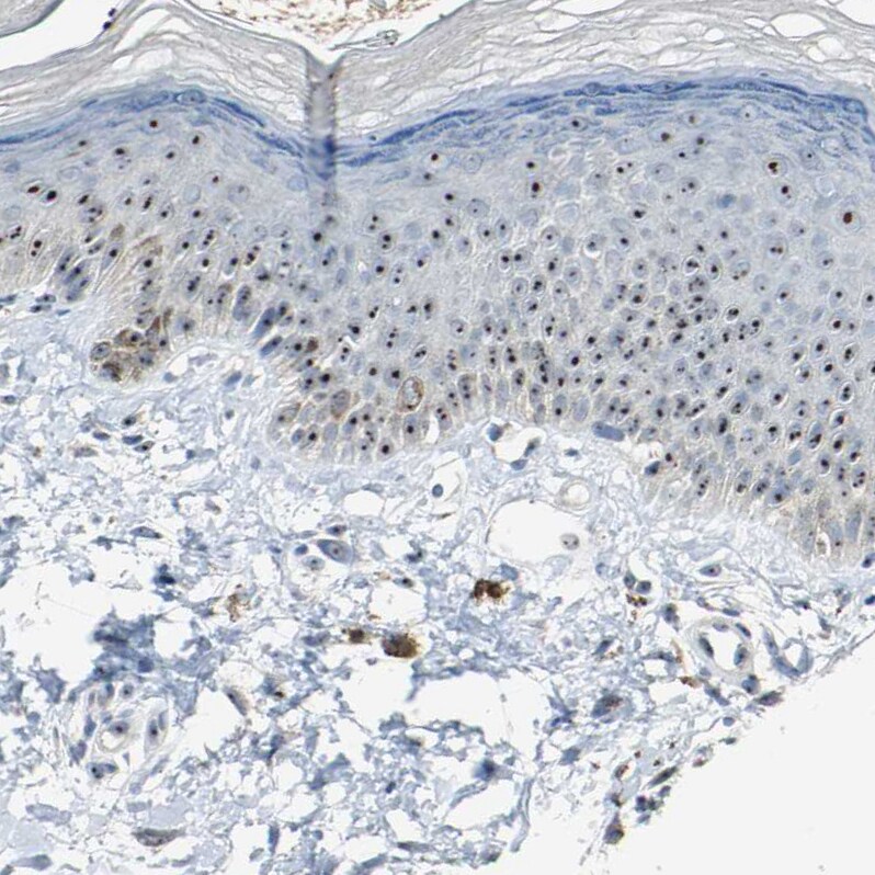 MYBBP1A Antibody - BSA Free Immunohistochemistry: MYBBP1A Antibody - BSA Free [NBP2-13630]