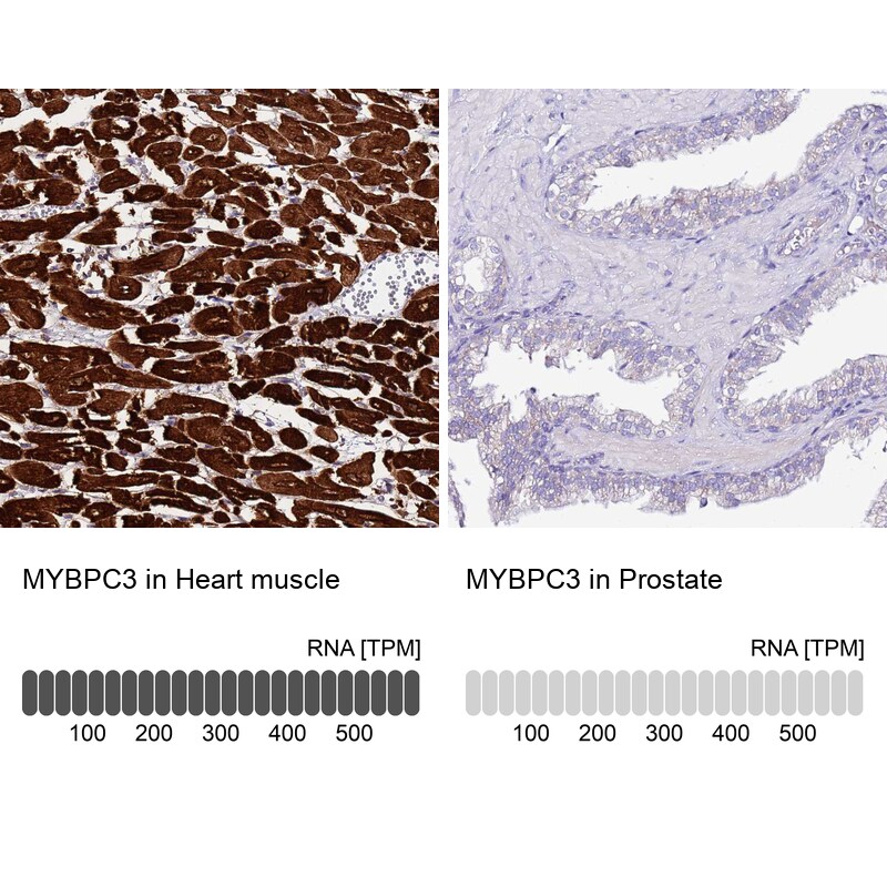 MyBPC3 Antibody - BSA Free Immunohistochemistry: MyBPC3 Antibody - BSA Free [NBP2-13632]
