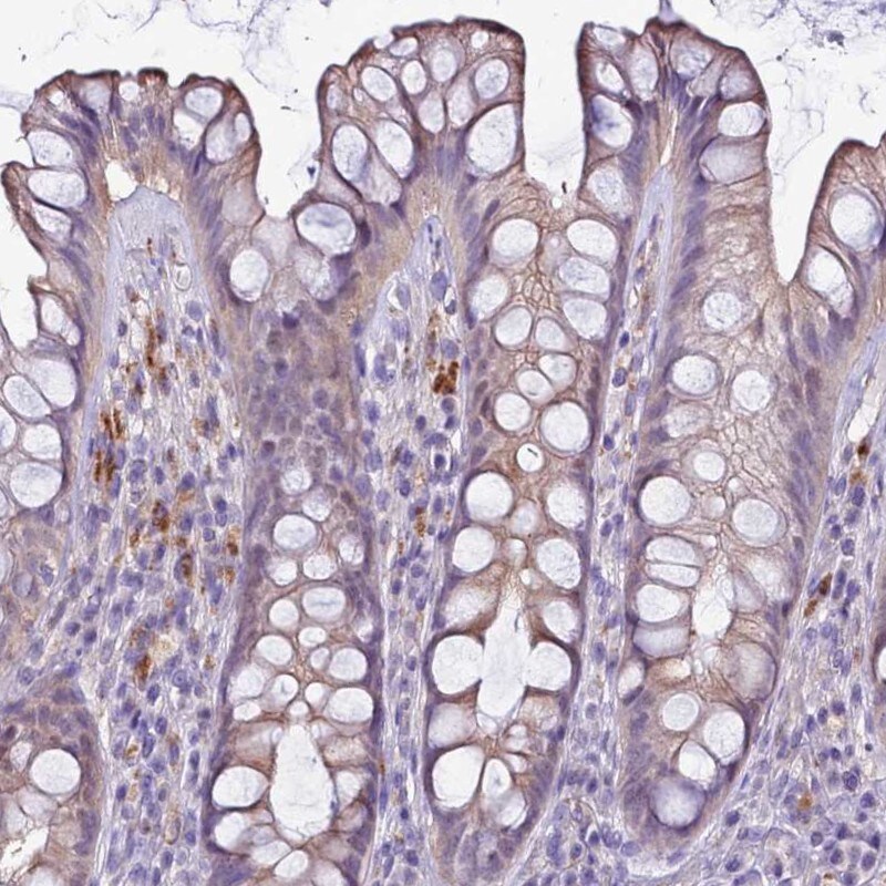 NAT1 Antibody - BSA Free Immunohistochemistry: NAT1 Antibody - BSA Free [NBP2-13641]