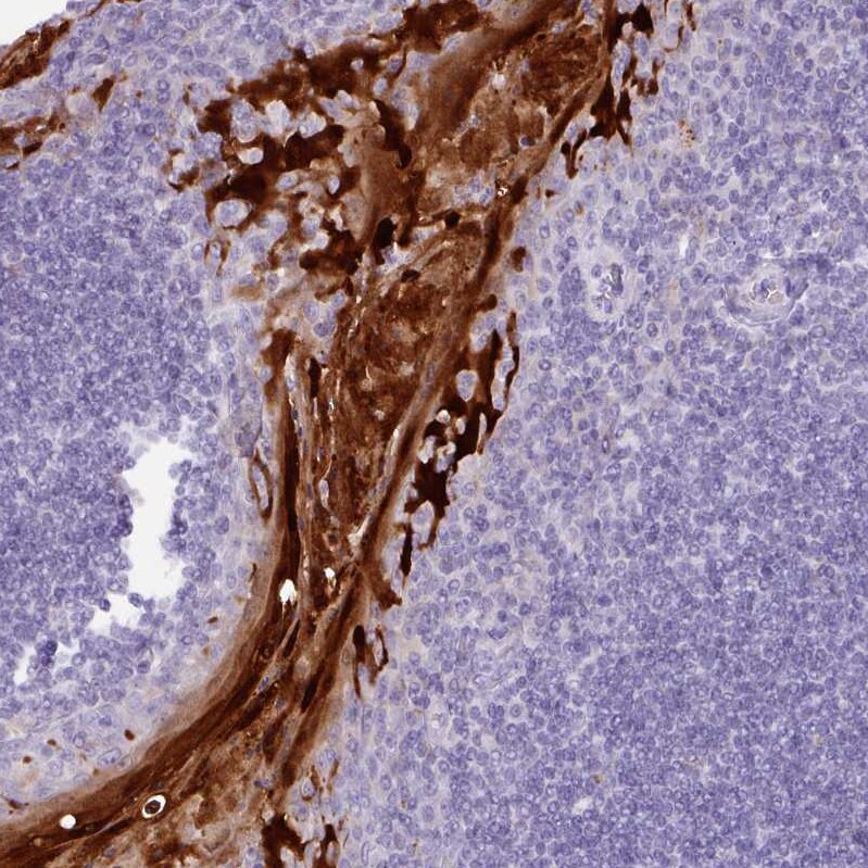NCCRP1 Antibody - BSA Free Immunohistochemistry: NCCRP1 Antibody - BSA Free [NBP2-13642]