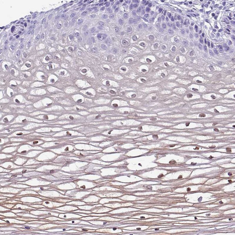 NCCRP1 Antibody - BSA Free Immunohistochemistry: NCCRP1 Antibody - BSA Free [NBP2-13642]