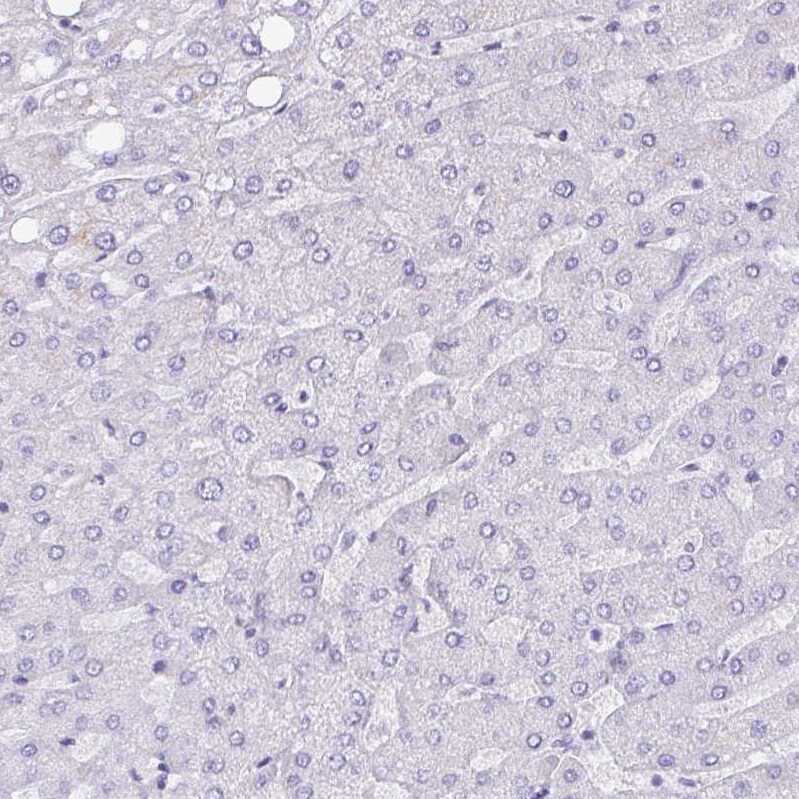 NCCRP1 Antibody - BSA Free Immunohistochemistry: NCCRP1 Antibody - BSA Free [NBP2-13642]