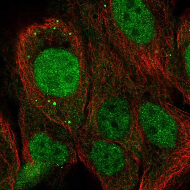 NET1 Antibody - BSA Free Immunocytochemistry/ Immunofluorescence: NET1 Antibody [NBP2-13653]