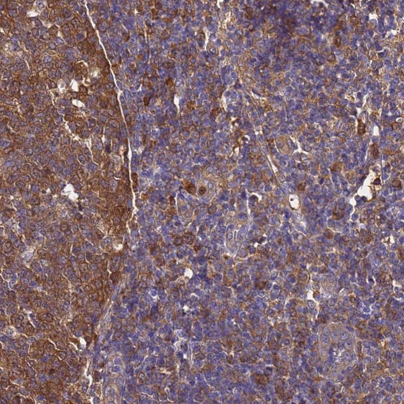 NM23-H1 Antibody - BSA Free Immunohistochemistry-Paraffin: NM23-H1 Antibody [NBP2-13662]