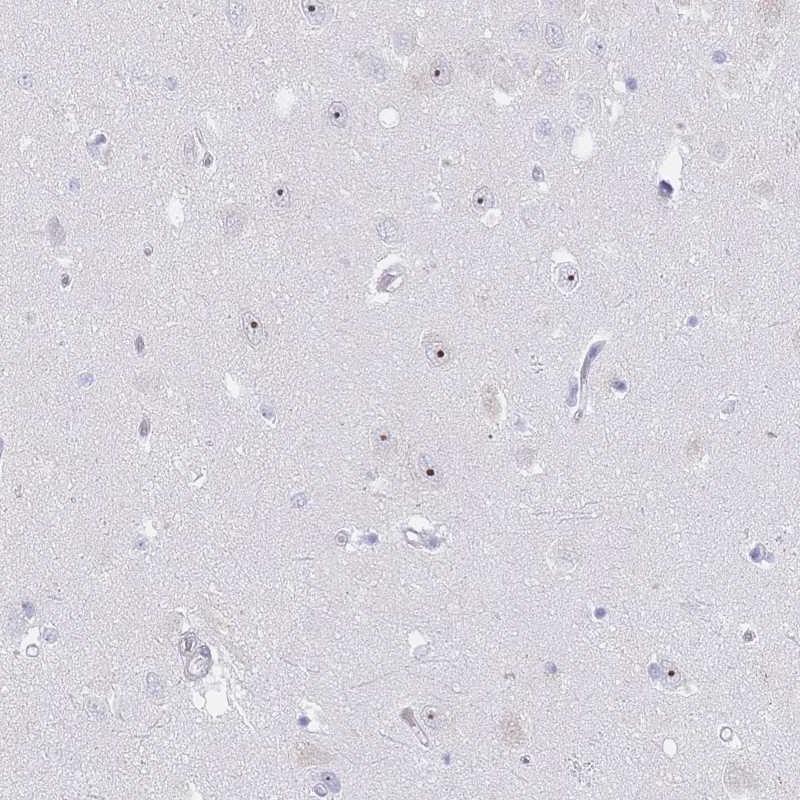 NOP14 Antibody - BSA Free Immunohistochemistry-Paraffin: NOP14 Antibody [NBP2-13665]