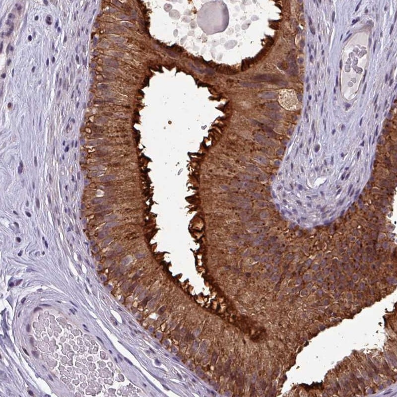 Neuropeptide FF R1/NPFFR1 Antibody - BSA Free Immunohistochemistry: Neuropeptide FF R1/NPFFR1 Antibody - BSA Free [NBP2-13671]