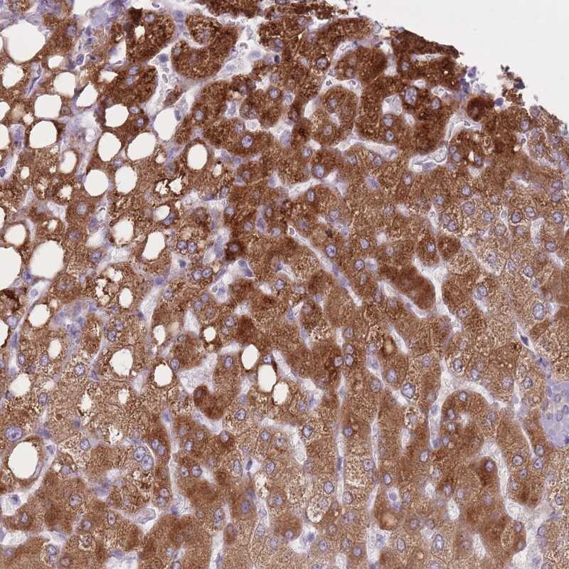 PGRMC2 Antibody - BSA Free Immunohistochemistry-Paraffin: PGRMC2 Antibody [NBP2-13753]