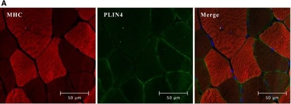 Perilipin-4 Antibody - BSA Free