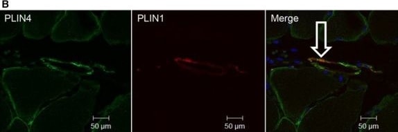 Perilipin-4 Antibody - BSA Free