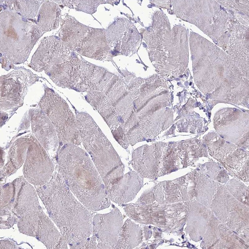PPIL3 Antibody - BSA Free Immunohistochemistry-Paraffin: PPIL3 Antibody [NBP2-13794]