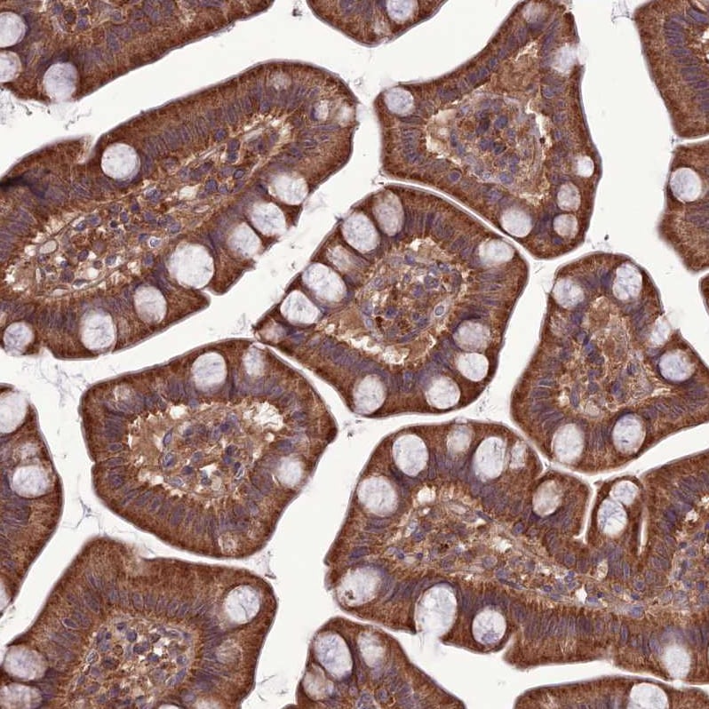 PPIL3 Antibody - BSA Free Immunohistochemistry-Paraffin: PPIL3 Antibody [NBP2-13794]