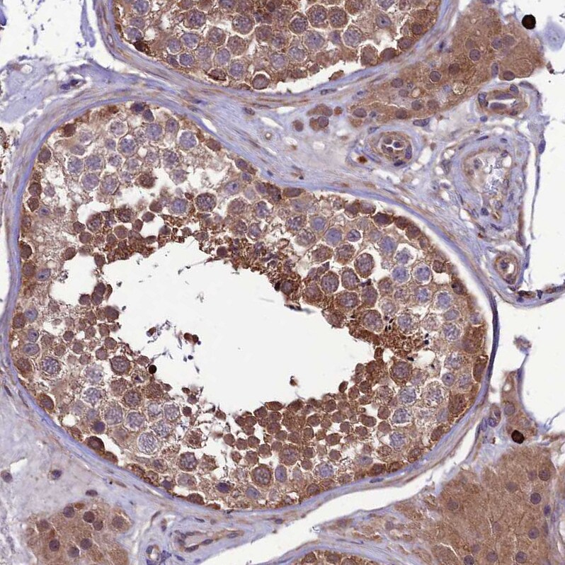 PPIL3 Antibody - BSA Free Immunohistochemistry-Paraffin: PPIL3 Antibody [NBP2-13794]