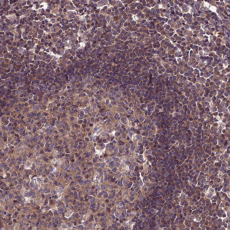 PPIL3 Antibody - BSA Free Immunohistochemistry-Paraffin: PPIL3 Antibody [NBP2-13794]