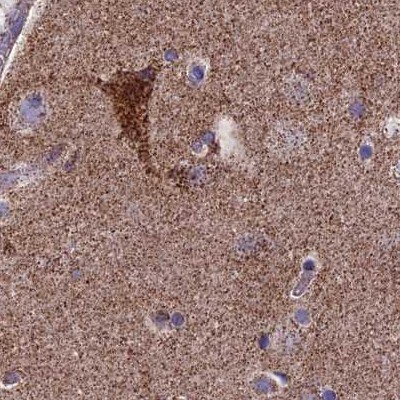 CS Citrate Synthase Antibody - BSA Free Immunohistochemistry-Paraffin: CS Citrate Synthase Antibody [NBP2-13877]