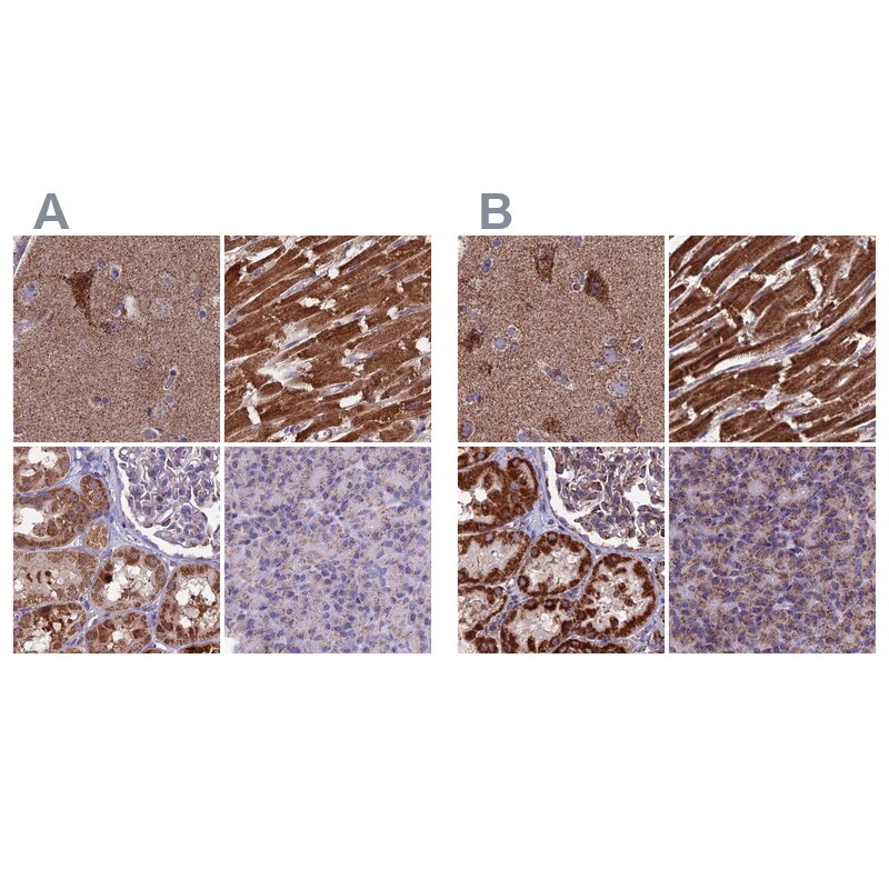 CS Citrate Synthase Antibody - BSA Free Immunohistochemistry-Paraffin: CS Citrate Synthase Antibody [NBP2-13877]