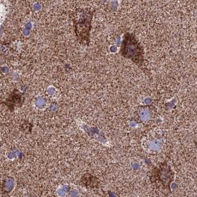 CS Citrate Synthase Antibody - BSA Free Immunohistochemistry-Paraffin: CS Citrate Synthase Antibody [NBP2-13878]