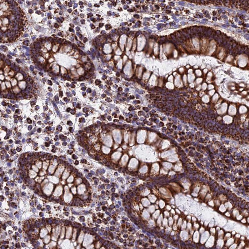 CS Citrate Synthase Antibody - BSA Free Immunohistochemistry-Paraffin: CS Citrate Synthase Antibody [NBP2-13878]