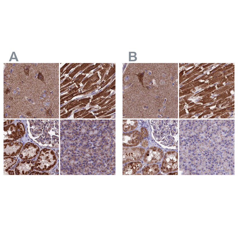 CS Citrate Synthase Antibody - BSA Free Immunohistochemistry-Paraffin: CS Citrate Synthase Antibody [NBP2-13878]