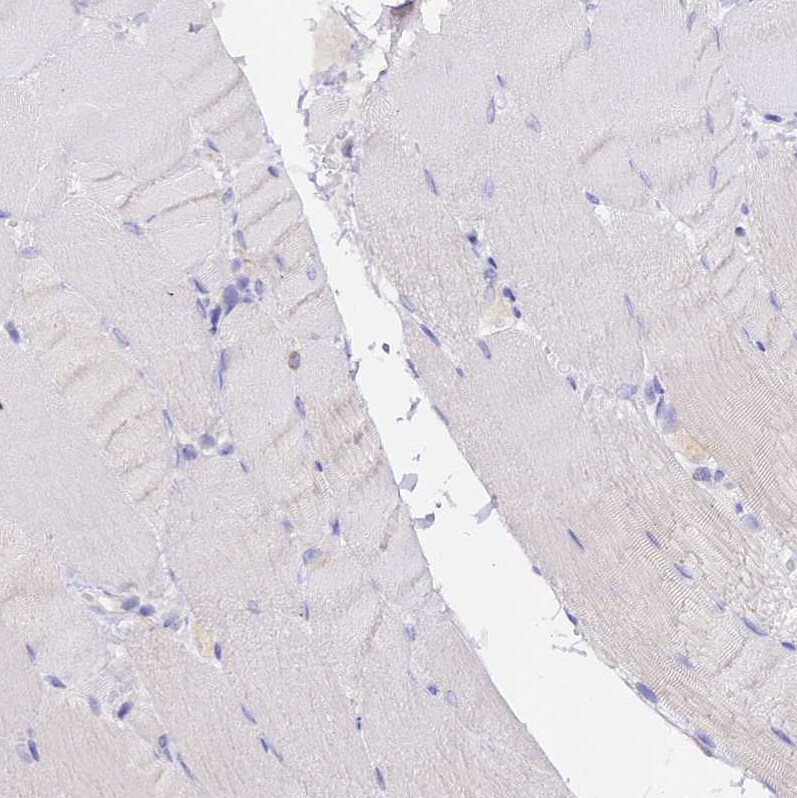 DONSON Antibody - BSA Free Immunohistochemistry-Paraffin: DONSON Antibody [NBP2-13931]