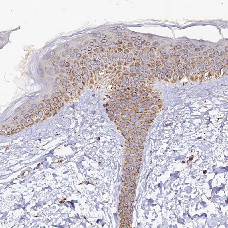 DONSON Antibody - BSA Free Immunohistochemistry-Paraffin: DONSON Antibody [NBP2-13931]
