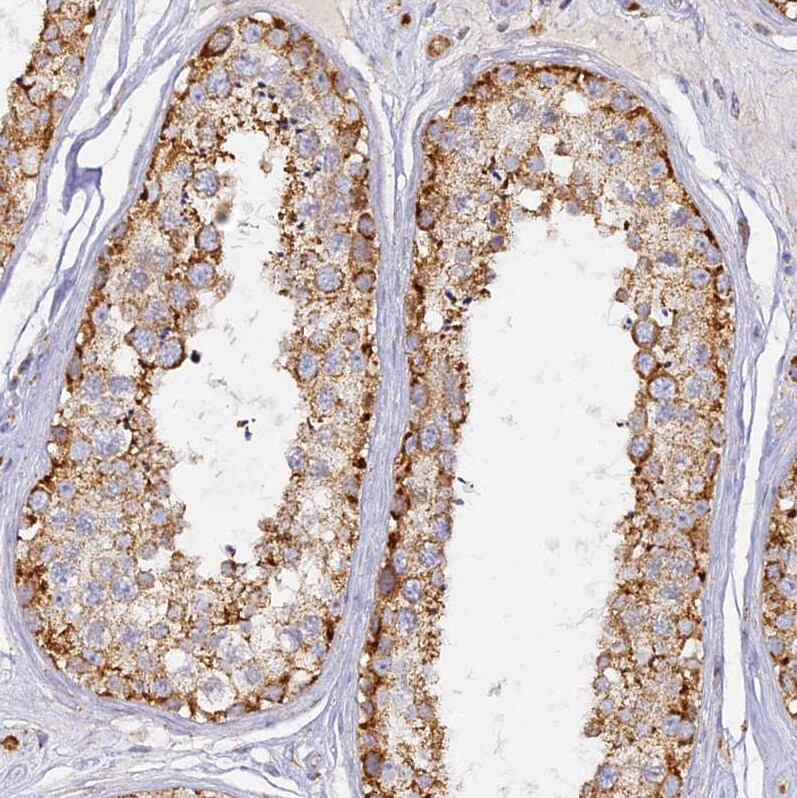DONSON Antibody - BSA Free Immunohistochemistry-Paraffin: DONSON Antibody [NBP2-13931]
