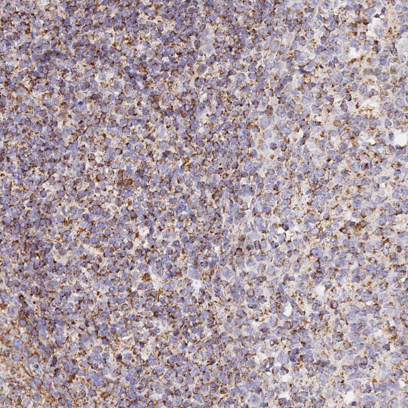 DONSON Antibody - BSA Free Immunohistochemistry-Paraffin: DONSON Antibody [NBP2-13931]