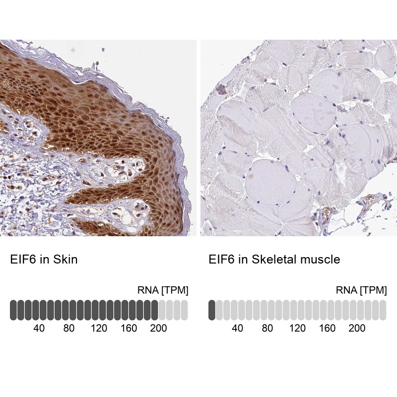 integrin beta 4 binding protein Antibody - BSA Free Immunohistochemistry-Paraffin: integrin beta 4 binding protein Antibody [NBP2-13954]