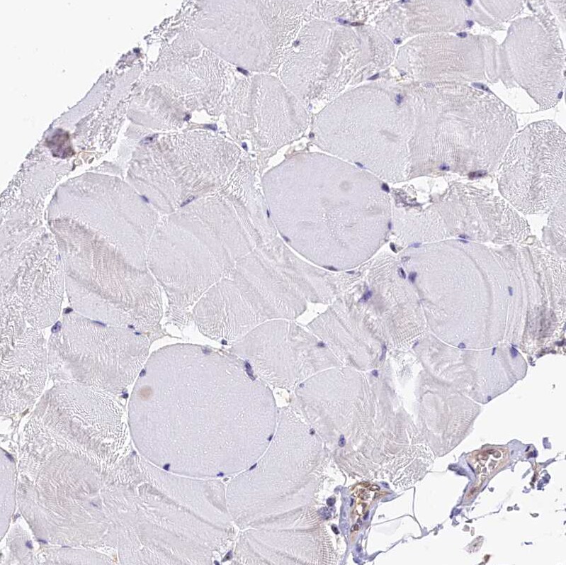 integrin beta 4 binding protein Antibody - BSA Free Immunohistochemistry-Paraffin: integrin beta 4 binding protein Antibody [NBP2-13954]