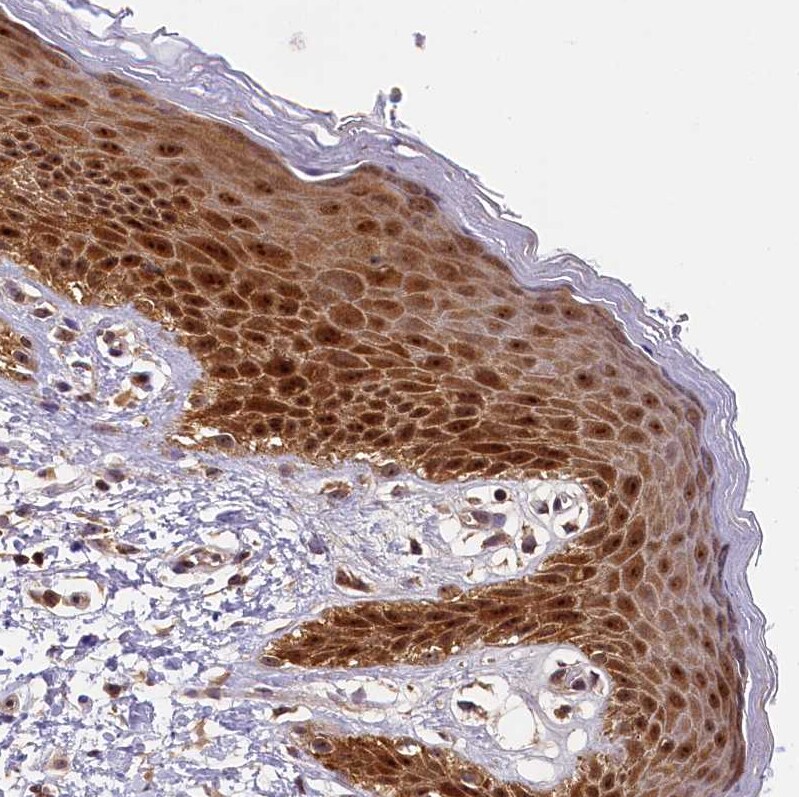 integrin beta 4 binding protein Antibody - BSA Free Immunohistochemistry-Paraffin: integrin beta 4 binding protein Antibody [NBP2-13954]