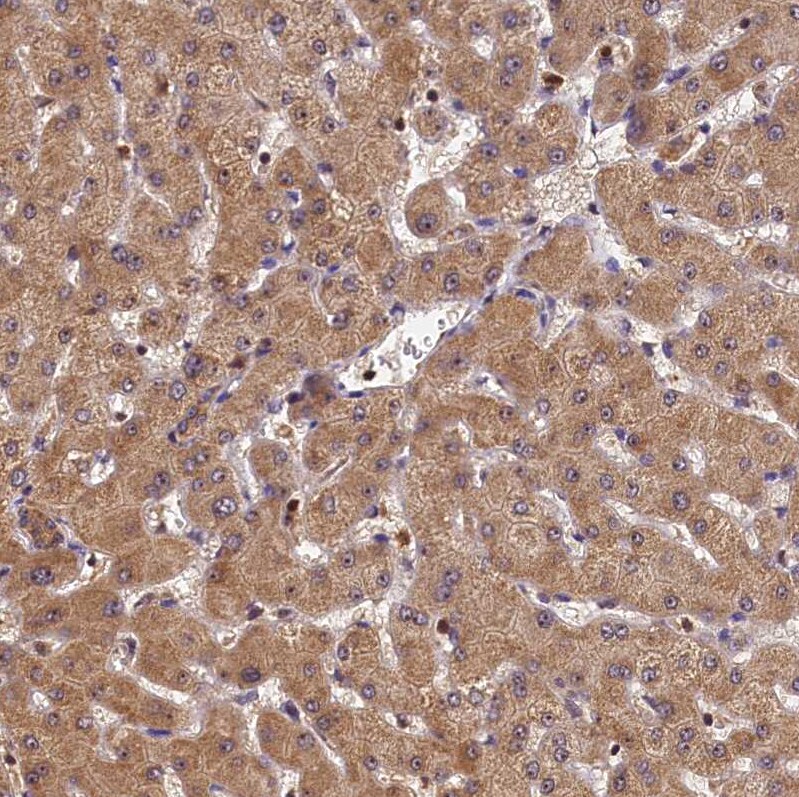 integrin beta 4 binding protein Antibody - BSA Free Immunohistochemistry-Paraffin: integrin beta 4 binding protein Antibody [NBP2-13954]