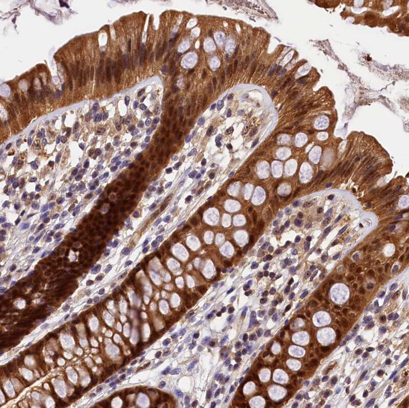 integrin beta 4 binding protein Antibody - BSA Free Immunohistochemistry-Paraffin: integrin beta 4 binding protein Antibody [NBP2-13954]
