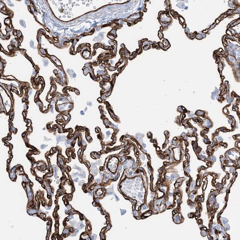 EPS8L3 Antibody - BSA Free Immunohistochemistry-Paraffin: EPS8L3 Antibody [NBP2-13966]